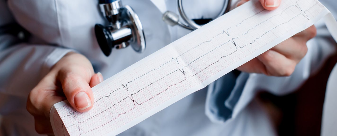 ekg papier